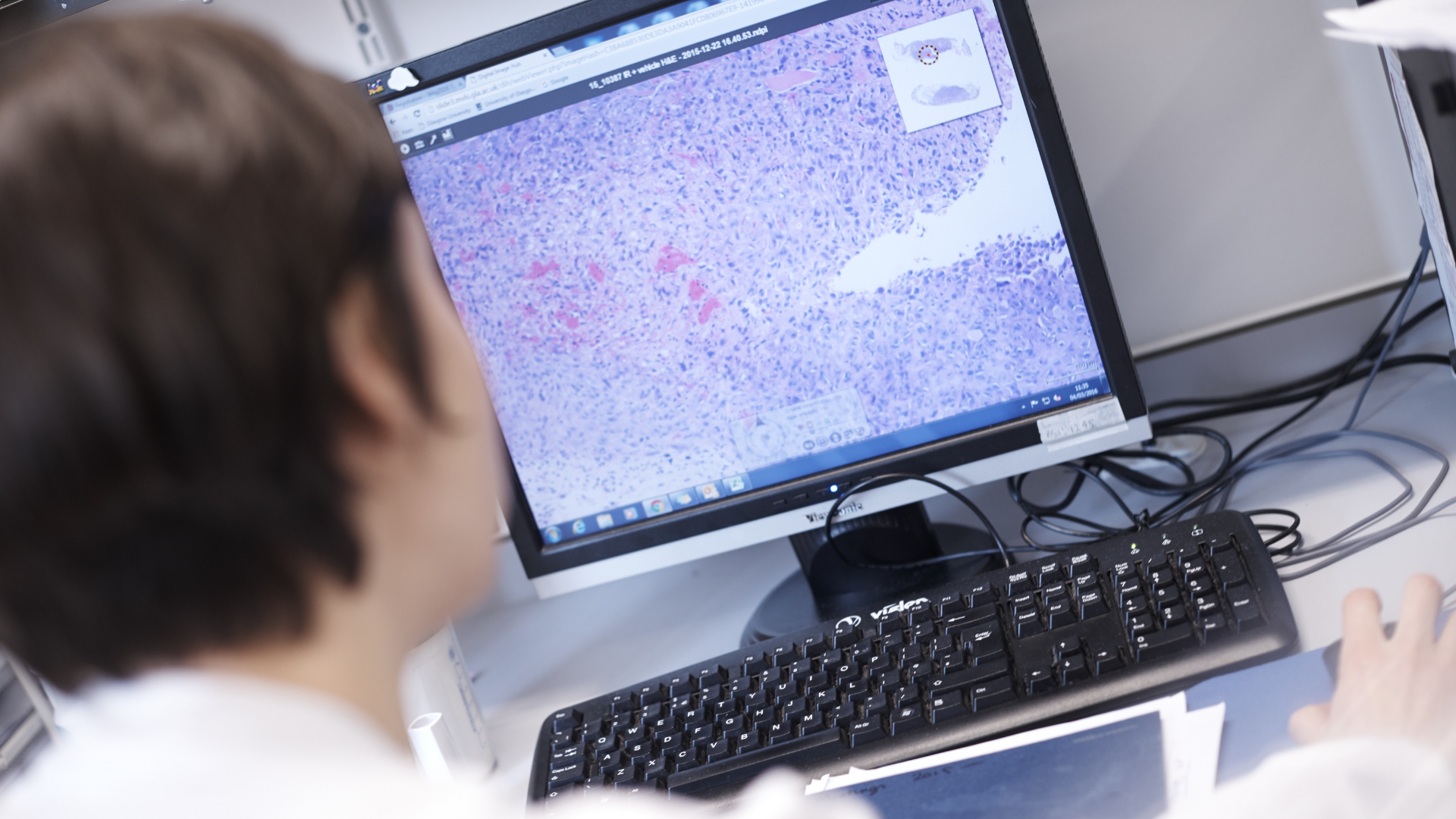 Radiotherapy Research